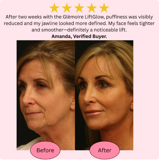 GlowCare EMS Face & Neck Massager