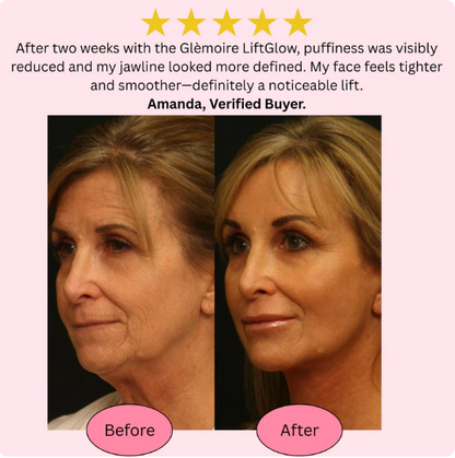 GlowCare EMS Face & Neck Massager