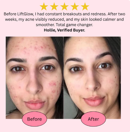 GlowCare EMS Face & Neck Massager